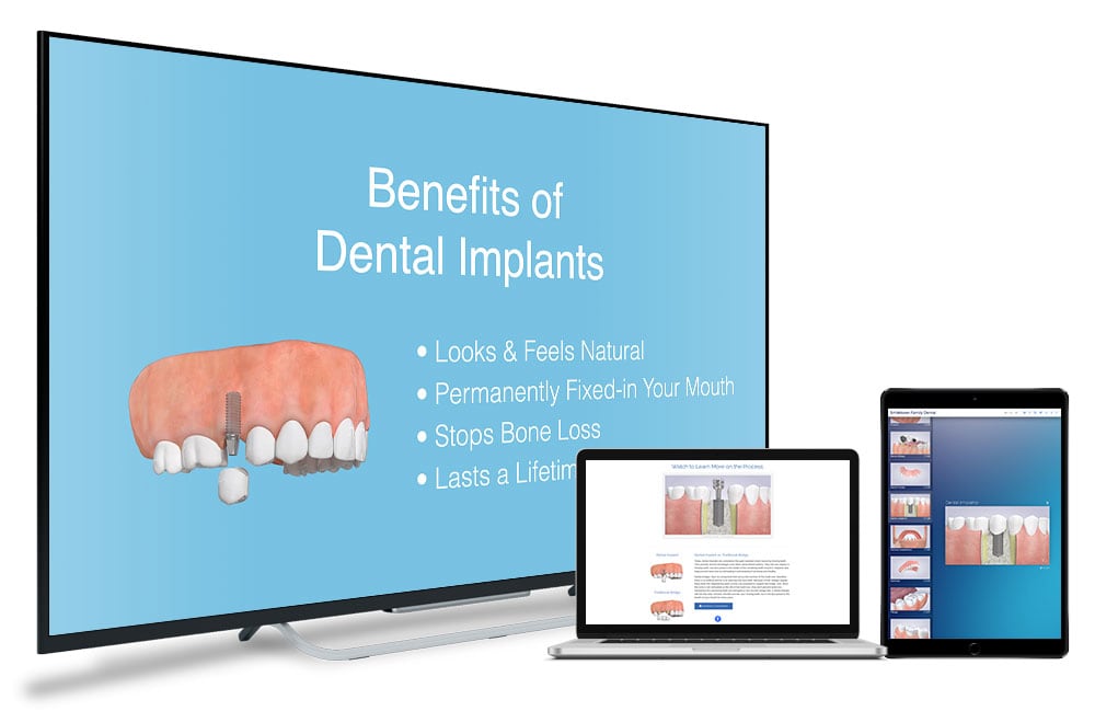The Complete Patient Education & Marketing System for Dentists